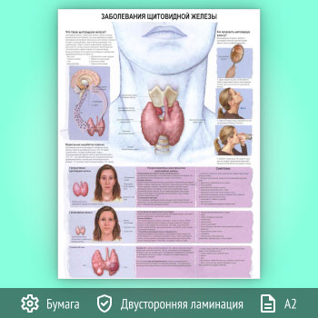 Плакат «Заболевания щитовидной железы» (ЗОЖ-36, 1 лист, А2)